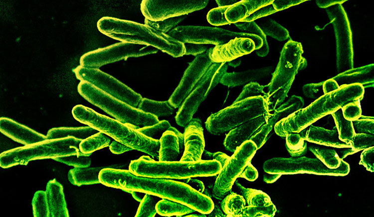 Which Strains of Tuberculosis Are the Most Infectious? | Harvard